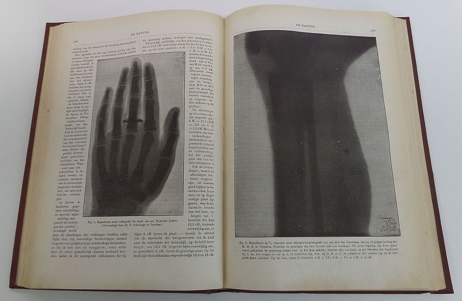 <p>De Veendammer röntgenfoto's in<em> </em><em>De Natuur </em>(1896). Rechts het been, met kogel, van Pieter Thedinga, links de hand van de 15- jarige Nicolaas Swarte. – Foto: Collectie Universiteitsbibliotheek Groningen.</p>