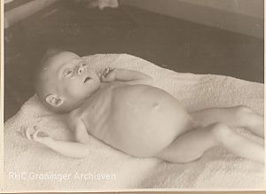 <p>Henkie, een jaar oud en nog geen negen pond, was &eacute;&eacute;n van de dertien Amsterdamse baby&rsquo;s uit het Babyhuis. &ndash; Foto: Ola Spruit-Stheeman, Groninger Archieven</p>
